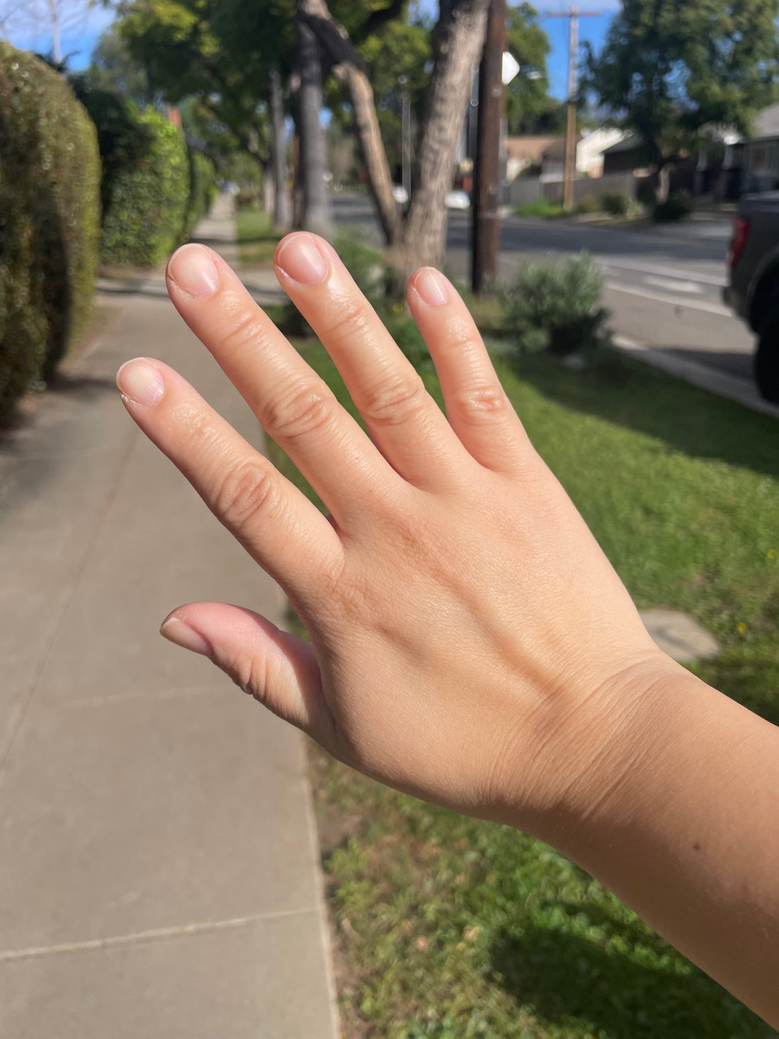 dryhands